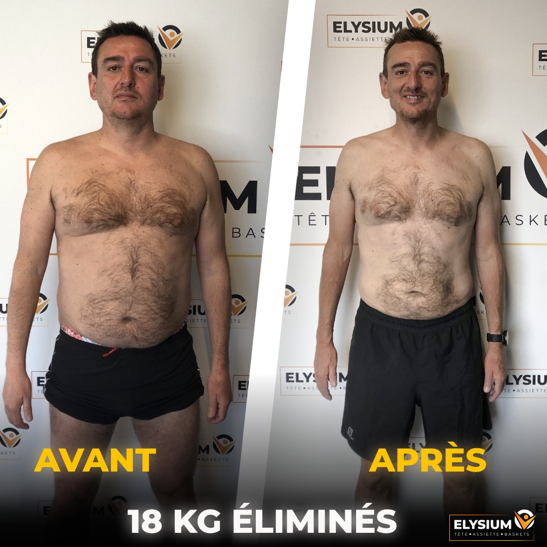 Avant et après : Aymeric, 18 kg éliminés, vue de face