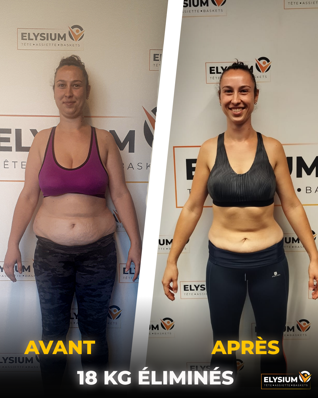 Avant et après : Solène, 18 kg éliminés, vue de face
