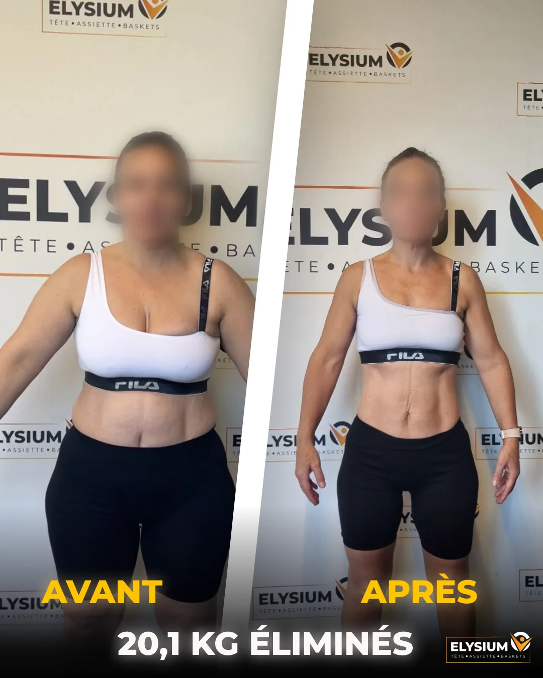 Avant et après : Aline, 20,1 kg éliminés, vue de face